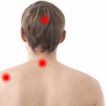 Rabaño de osteocondrose