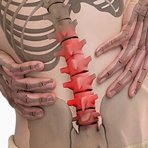 Osteocondrose da columna lumbar